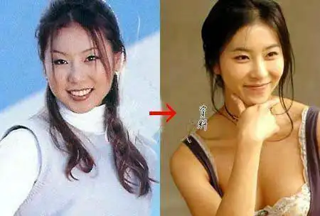 崔智友蔡琳尹恩惠刘仁娜刘荷娜韩恩贞金宣儿郑丽媛李多海朴诗妍_韩国整容女明星颜值变化_韩剧整容女明星