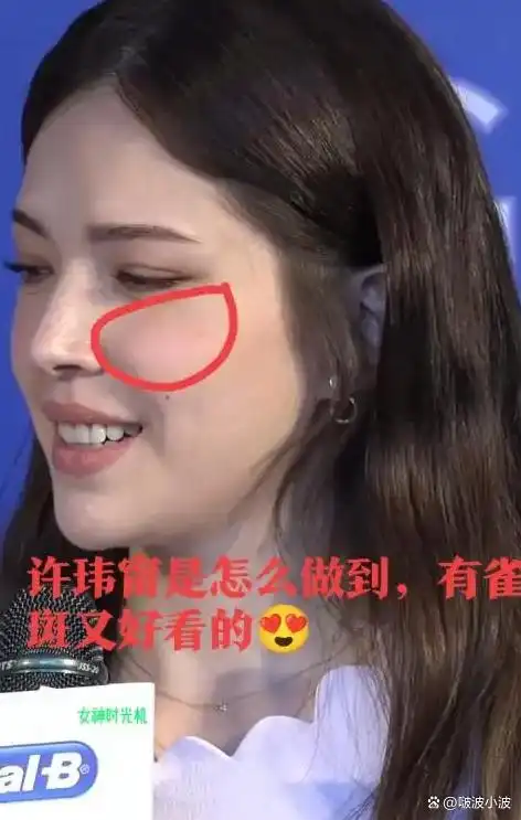 许玮甯长雀斑，网友：许玮甯的雀斑真加分，天生好基因自然美最动人